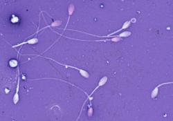 Как образуется сперма